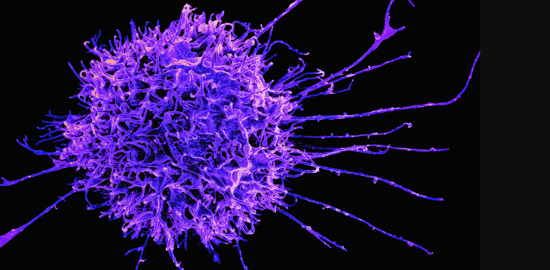 IMU Biosciences Completes $53m Series A